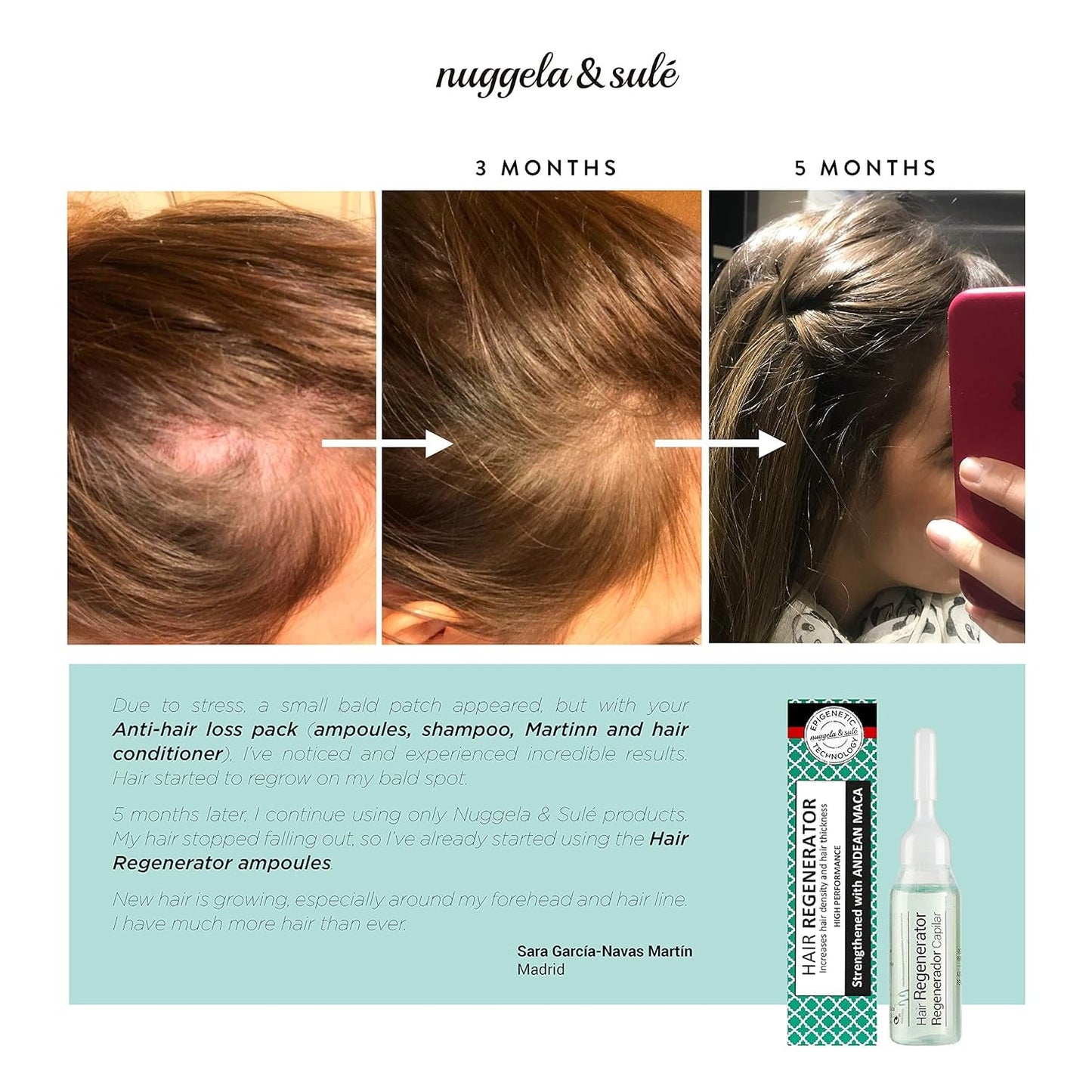 Nuggela & Sulé Ampułki z odżywką do włosów, kuracja na 1 tydzień, 10 ml pielęgnacji włosów Nuggela
