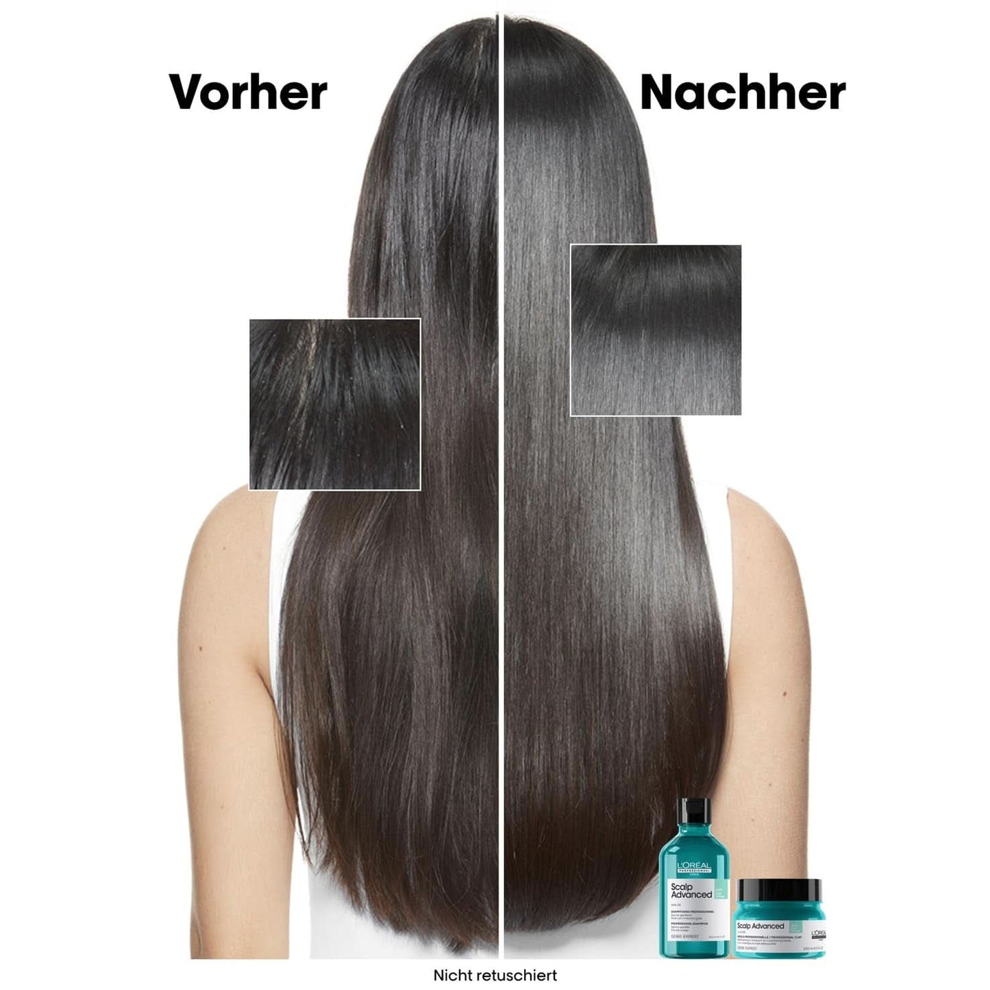 L'Oréal Professionnel Oczyszczający szampon do tłustej skóry głowy, 300ml Naty Shop Prysznic i Kąpiel