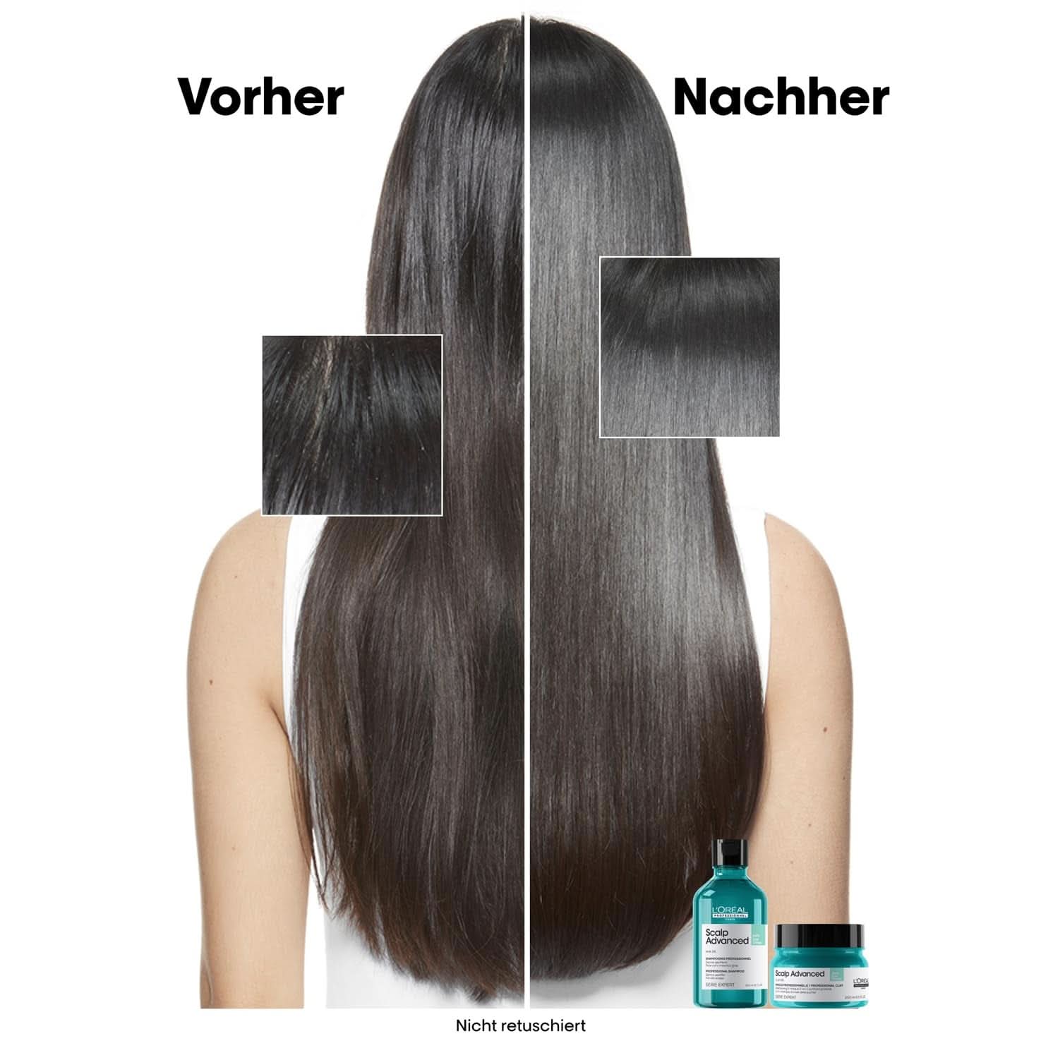 L'Oréal Professionnel Oczyszczający szampon do tłustej skóry głowy, 300ml Naty Shop Prysznic i Kąpiel