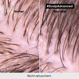 L'Oréal Professionnel Oczyszczający szampon do tłustej skóry głowy, 300ml Naty Shop Prysznic i Kąpiel