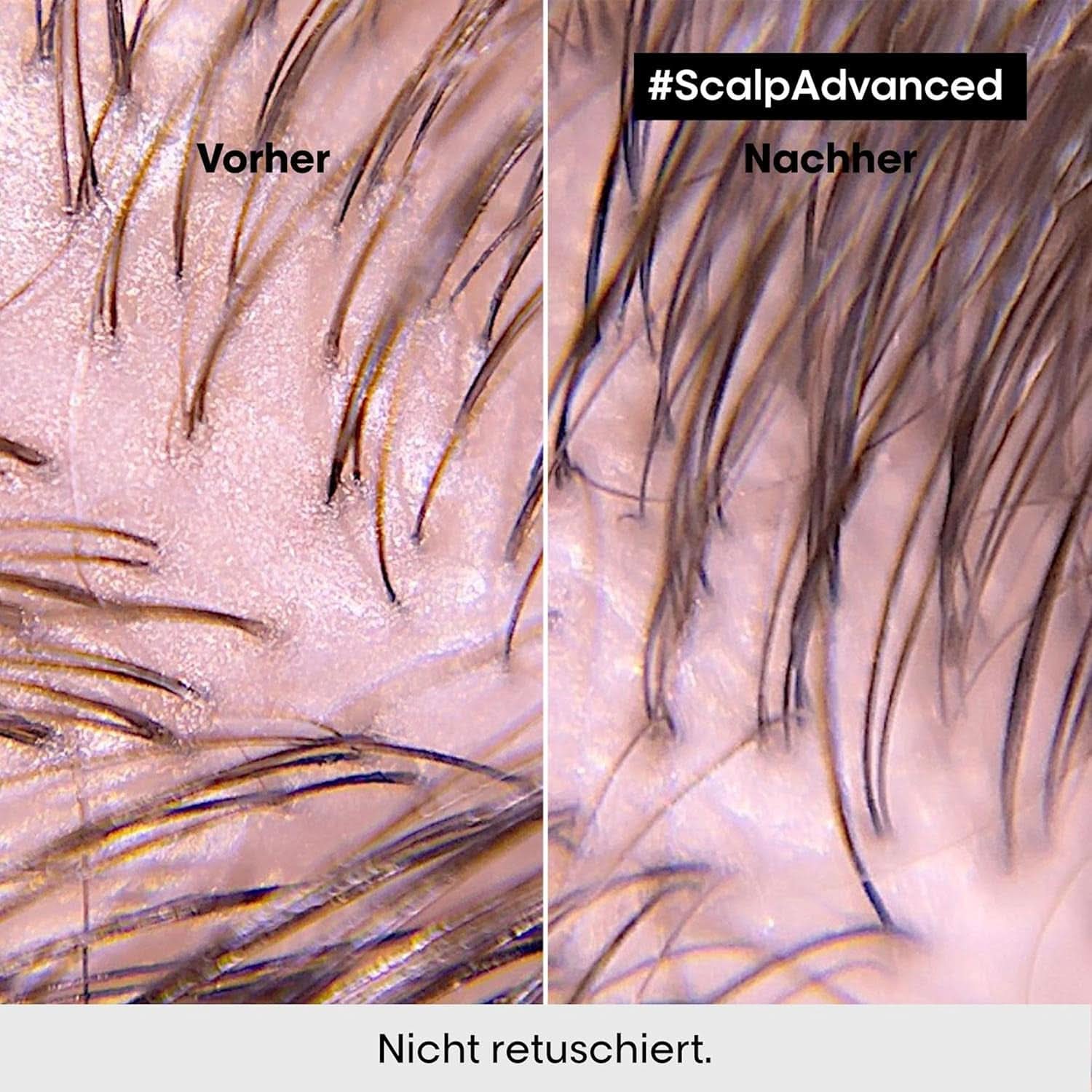 L'Oréal Professionnel Oczyszczający szampon do tłustej skóry głowy, 300ml Naty Shop Prysznic i Kąpiel