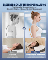 Poduszka ortopedyczna na ból szyi Poduszka z pianki memory Ergonomiczna poduszka zapewniająca optymalne podparcie Poduszka podtrzymująca szyję do bocznej stabilizacji pleców i brzucha Poduszki ortopedyczne szyjki macicy Naty Shop